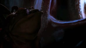 Zerebrale Dichotomie